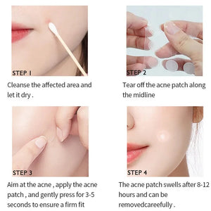 Invisible Acne Patches